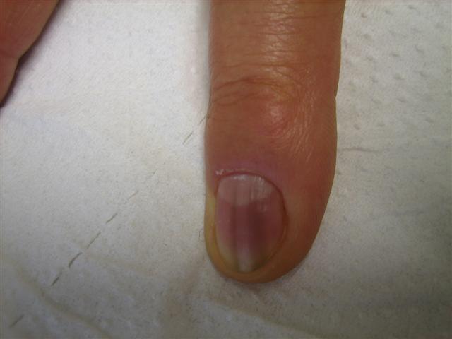 Linea_nera_058_Small.jpg